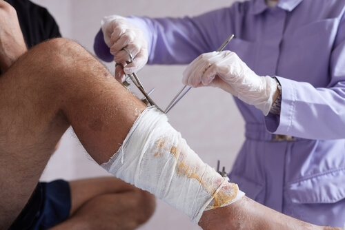 Doctor bandaging. What to Do After a Dog Bite?