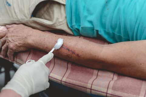 The Steps to Take after a Dog Bite in New Jersey
